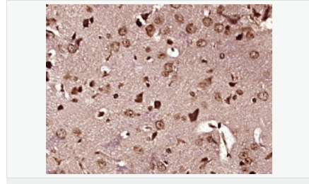 6052b026d9de3.png image.png