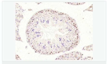 6052b6d3d345d.png image.png