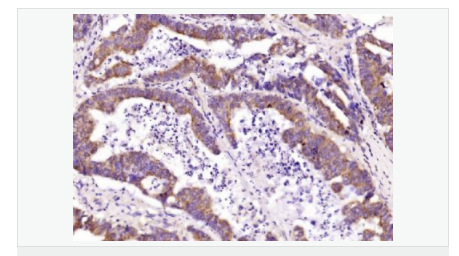 605432efd4842.png image.png