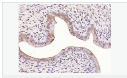 60584c7c8764f.png image.png