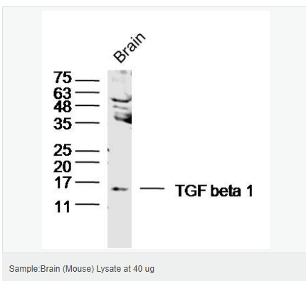 6059507254b16.png image.png