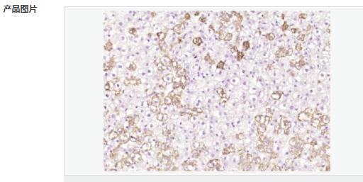 605ab11d48757.png image.png