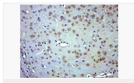 6066797e385d0.png image.png