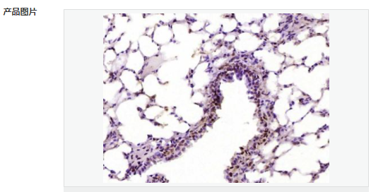 6076491fa61b2.png image.png