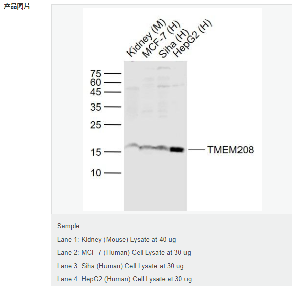 6079338910a1b.png image.png